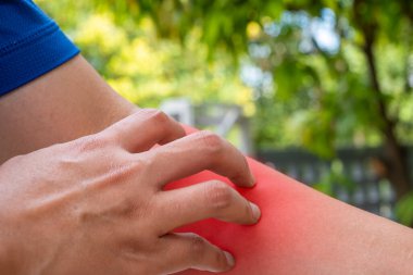 Cilt kızarıklığı ve ön kolda kaşıntı muhtemelen alerji, enfeksiyon ya da deri iltihabından kaynaklanıyor. Dermatoloji veya cilt bakımını desteklemek için ideal.