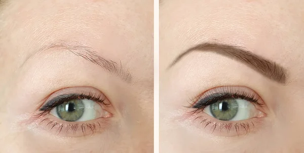 eyebrows before and after correction