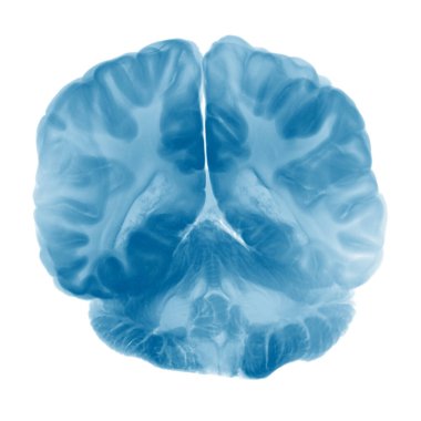 Beyazların Arkaplanda Beyin Korteksinin Çapraz Bölümü