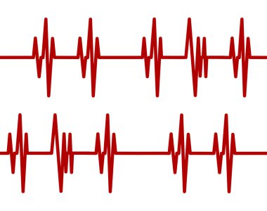 Repeating red heartbeat line on a white background. Medical EKG or ECG cardiogram illustration