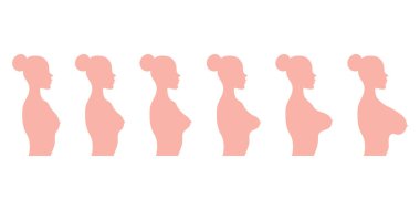 Kadınların göğüs anatomisi implantı. Tıbbi kadın diyagramı