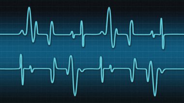 Blue Heartbeat Line Banner Dark Blue Background. Heart Rate Drawing. Medical Themed Background. Blue Shade Colors