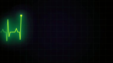 Dijital elektrokardiyogram görüntüsü, yeşil çizgiler ve parlak sarı bir nabzı olan, koyu bir şebekede sağlıklı bir kalp atışı dalgası gösteriyor.