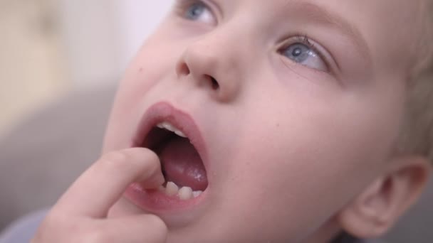 De cerca retrato niño toca dedo el diente de leche, que tambalea — Vídeos de Stock