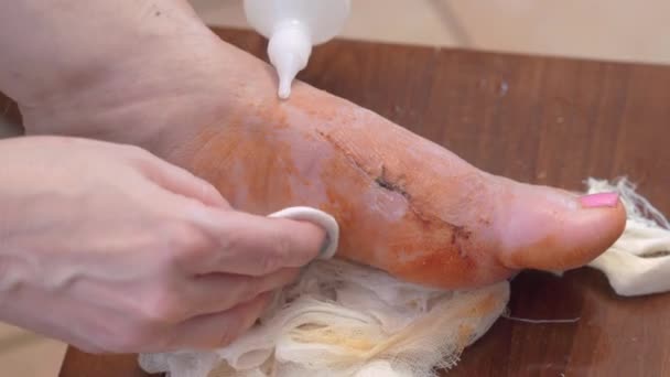 Lady χύνει αντισηπτικό να καθαρίσει πληγή με τα πόδια τεθεί σε σκαμνί — Αρχείο Βίντεο