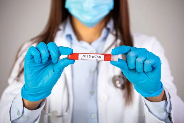 Nővér Véres Kémcsövet Tart 2019 Ncov Analízishez Kínai Coronavirus Vérvizsgálat — Stock Fotó