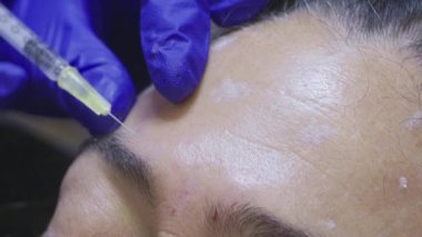 Profesyonel estetik tıp doktoru bir hastaya yüz hatları çiziyor. Güzellik uzmanı bir güzellik kliniğinde kırışıklık önleyici iğne yapıyor.