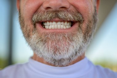 Bearded man with gold fillings giving a toothy smile in close up on his teeth and jaw outdoors clipart