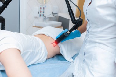 Modern kozmetolojide lazer donanımlı bir yaranın silinmesi.