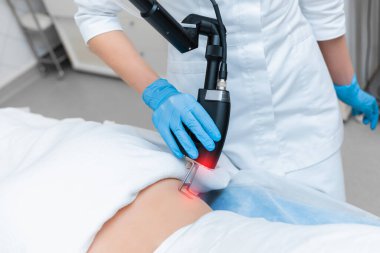 Bir doktorun elindeki lazer bıçağı. Modern kozmetolojide vücuttaki yaraların çıkarılması.