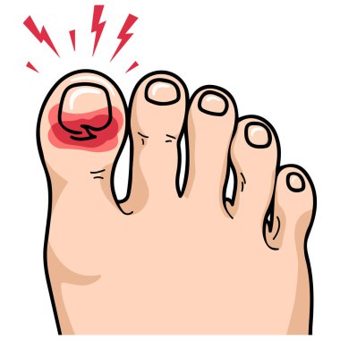 Şişmiş ayak parmağı çizgi film stili beyaz arka planda izole edilmiş vektör çizimi