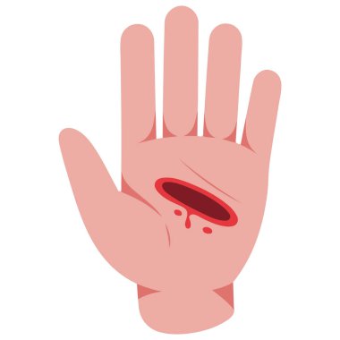 Tıbbi dikişlerle cilt yaralanması beyaz arka planda izole edilmiş vektör çizimi