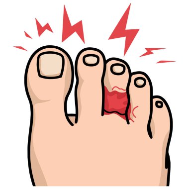 ağrılı ayak parmağı tıbbi vektörü beyaz arka planda izole vektör çizimi