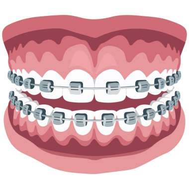 Gülümse diş hizalama beyazlatma işlemi beyaz arkaplanda izole vektör çizimi