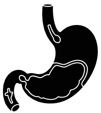İnsan mide anatomisinin basitleştirilmiş siyah beyaz çizimi