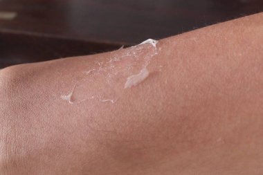 Güneş yanığı ya da susuzluk etkisi, deri dokusu detayı, cilt bakımı ve cilt bakımı gibi kuru katmanı olan insan derisine yakın çekim.