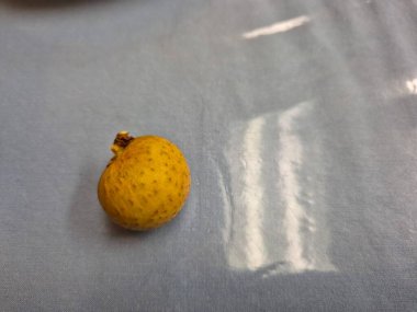 Arka planda taze Longan meyvelerinin yakın çekimi yumuşak bir mavidir, meyvelerin sıcak tonlarıyla güzel bir tezat oluşturur.