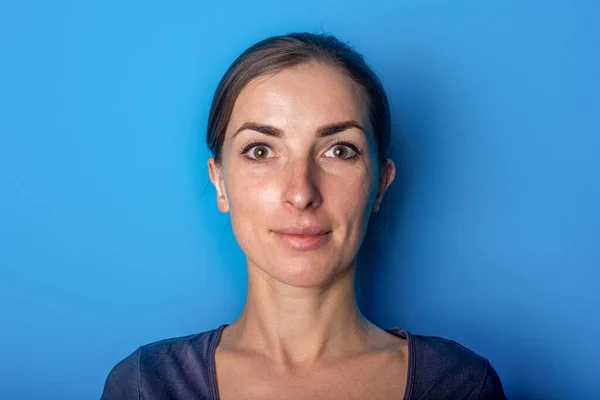 Hermosa Mirada Joven Feliz Las Orejas Después Otoplastia Sobre Fondo —  Fotos de Stock