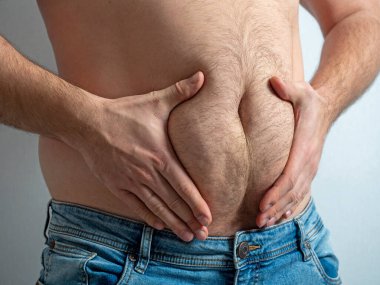 Kot pantolonlu adam kıllı, sarkık, şişman karnını sıkıyor. Yetersiz beslenme kavramı. Vücut pozitif. Kendini kabullenme