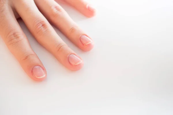 Крупный План Женской Руки Чистым Лаком Ногтей Защита Уход Ногтями — стоковое фото