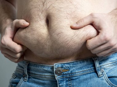 Şişman karnının yağlarını tutan bir adamın yakın çekimi. Aşırı kilolarla ilgili problemler, kilo verme kliniği