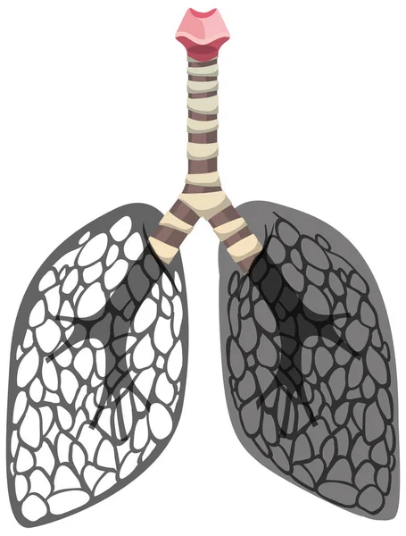 Lungor Cancer Ikon Isolerad Vit Bakgrund Illustration — Stock vektor