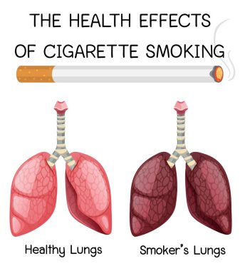 Poster on health effects of cigarette smoking illustration clipart