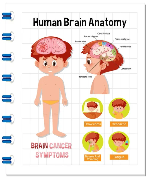 Informační Plakát Ilustrací Diagramu Lidského Mozku — Stockový vektor