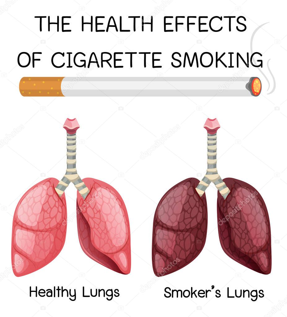 Poster on health effects of cigarette smoking illustration