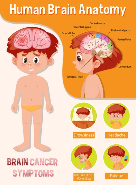 Інформаційний Плакат Ілюстрації Діаграми Людського Мозку — стоковий вектор