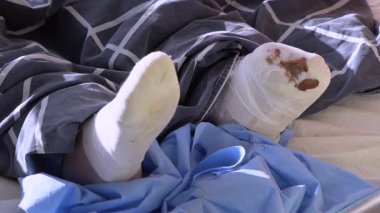 Yakından bakıldığında, yaşlı ve kuru deri dokusunu vurguluyor. Yumuşak bir kumaş üzerinde dinlenen yaşlı bir insan eli ya da bir hastalık anında. Yüksek kaliteli FullHD görüntüler