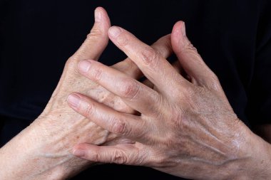 Siyah arka planda yaşlı bir kadının kırışık elleri.