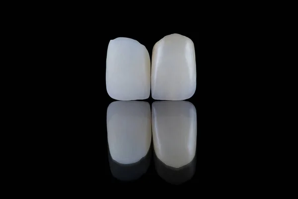 Close up artificial lithium-disilicate dental crowns of central incisors unpainted and painted. — Stock Photo, Image