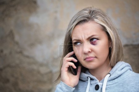 Foto de Mujer asustada con moretones en la cara llamando para pedir ayuda - Imagen libre de derechos