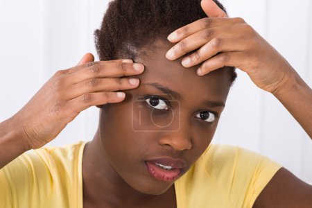 Foto de Primer plano de mujer africana joven mirando grano en la frente - Imagen libre de derechos