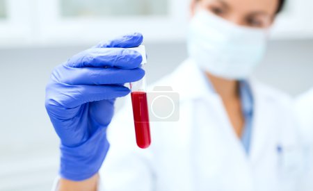 primer plano del científico que sostiene el tubo de ensayo en el laboratorio
