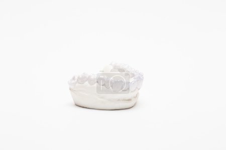 Bandeja dental individual de primer plano Ortodoncia tema dental. Tirantes invisibles
Bandeja dental individual de primer plano Ortodoncia tema dental. Tirantes invisibles