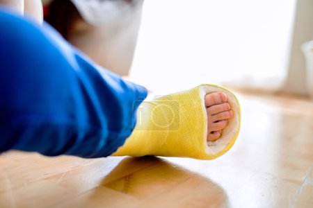 Photo for Broken leg in cast of unrecognizable little boy sitting on the wooden floor. - Royalty Free Image