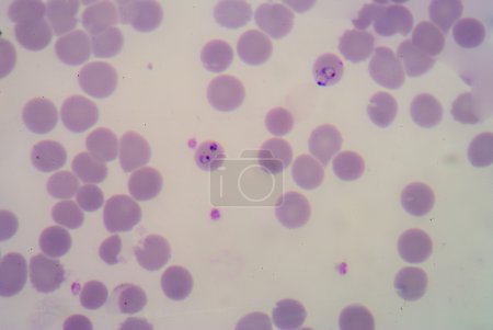 películas de sangre para el parásito de la malaria
.