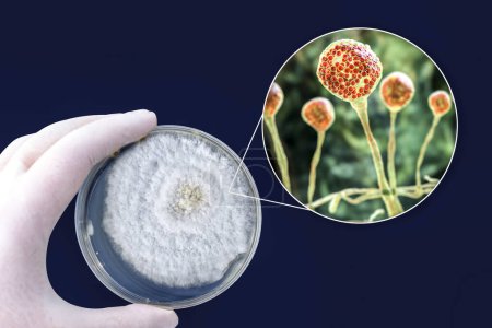 Colonia de hongos Mucor cultivados en laboratorio en placa Petri. También conocido como hongo negro y hongo amarillo, el agente causal de la mucormicosis después de Covid-19. Ilustración 3D muestra vista de primer plano de Mucor Colonia de hongos Mucor cultivados en laboratorio en placa Petri. También conocido como hongo negro y hongo amarillo, el agente causal de la mucormicosis después de Covid-19. Ilustración 3D muestra vista de primer plano de Mucor